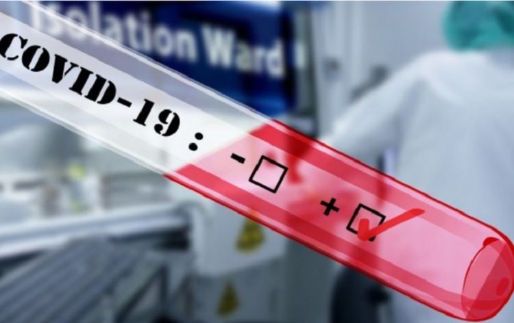 За пръв път: 32-годишен е новият случай с covid-19 в Смолян 