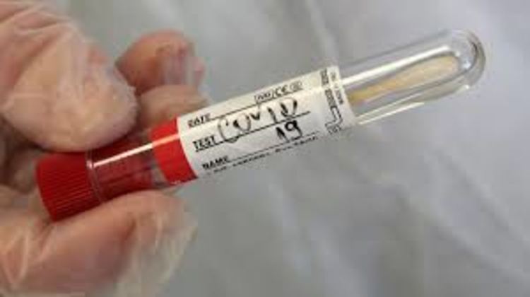 Решиха проблема с PCR-тестовете в Смолян.Срещу 120 лева ДКЦ поема тестването по желание